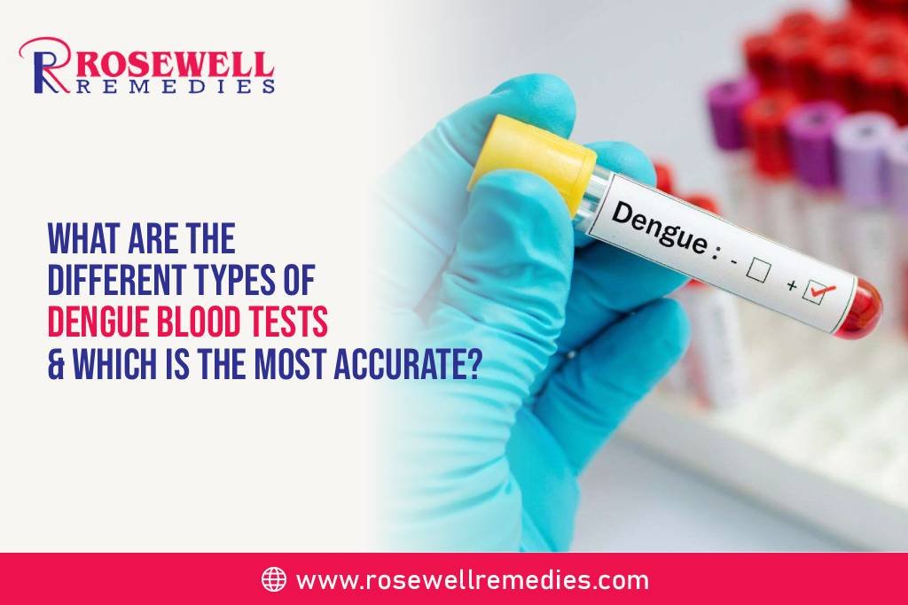 What are the Different Types of Dengue Blood Tests & Which is the Most Accurate?